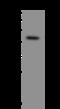Corticotropin Releasing Hormone Receptor 2 antibody, 206176-T32, Sino Biological, Western Blot image 