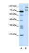 Zinc Finger Protein 709 antibody, MBS832315, MyBioSource, Western Blot image 