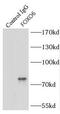 Forkhead box protein O6 antibody, FNab03205, FineTest, Immunoprecipitation image 