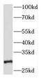 3-oxo-5-alpha-steroid 4-dehydrogenase 1 antibody, FNab08219, FineTest, Western Blot image 