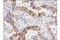 FGFR-2 antibody, 23328S, Cell Signaling Technology, Immunohistochemistry paraffin image 