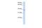 Chromosome 21 Open Reading Frame 91 antibody, GTX46518, GeneTex, Western Blot image 