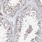 Leucine Rich Repeats And IQ Motif Containing 3 antibody, NBP1-92078, Novus Biologicals, Immunohistochemistry frozen image 