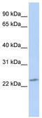 RNA Binding Protein, MRNA Processing Factor 2 antibody, TA344038, Origene, Western Blot image 