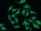 Receptor Like Tyrosine Kinase antibody, FNab07548, FineTest, Immunofluorescence image 