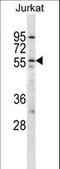 Hypocretin Receptor 2 antibody, LS-C166818, Lifespan Biosciences, Western Blot image 