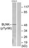 BLNK antibody, PA5-38357, Invitrogen Antibodies, Western Blot image 