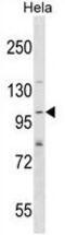SH3 And PX Domains 2A antibody, GTX50879, GeneTex, Western Blot image 