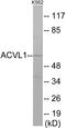 Activin A Receptor Like Type 1 antibody, EKC1717, Boster Biological Technology, Western Blot image 