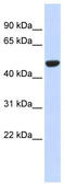 Isocitrate dehydrogenase [NADP], mitochondrial antibody, TA346571, Origene, Western Blot image 