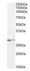 Glutathione S-transferase Mu 3 antibody, orb1839, Biorbyt, Western Blot image 