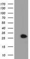 Glutathione S-Transferase Theta 2 (Gene/Pseudogene) antibody, TA501858, Origene, Western Blot image 