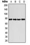 BMX Non-Receptor Tyrosine Kinase antibody, GTX32164, GeneTex, Western Blot image 