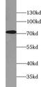 Mitogen-Activated Protein Kinase Kinase Kinase 3 antibody, FNab09784, FineTest, Western Blot image 