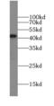 Zinc Finger Protein 830 antibody, FNab05992, FineTest, Western Blot image 