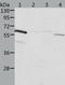 Aldehyde Dehydrogenase 6 Family Member A1 antibody, TA324301, Origene, Western Blot image 