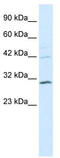 Homeobox protein Hox-B5 antibody, TA329288, Origene, Western Blot image 