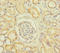 Succinate-CoA Ligase ADP-Forming Beta Subunit antibody, LS-C676560, Lifespan Biosciences, Immunohistochemistry paraffin image 