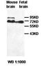 Polypeptide N-Acetylgalactosaminyltransferase 9 antibody, orb77588, Biorbyt, Western Blot image 