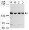 CARP1 antibody, GTX110892, GeneTex, Western Blot image 