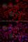 Muscle LIM protein antibody, A6569, ABclonal Technology, Immunofluorescence image 