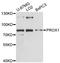 Prospero homeobox protein 1 antibody, LS-C748105, Lifespan Biosciences, Western Blot image 