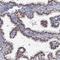 Chromosome 11 Open Reading Frame 96 antibody, NBP1-90866, Novus Biologicals, Immunohistochemistry frozen image 