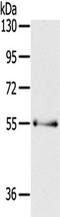 P21 (RAC1) Activated Kinase 3 antibody, TA350833, Origene, Western Blot image 