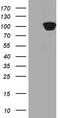 Glycogen Phosphorylase, Muscle Associated antibody, TA811295, Origene, Western Blot image 