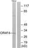 Olfactory Receptor Family 4 Subfamily F Member 17 antibody, GTX87184, GeneTex, Western Blot image 