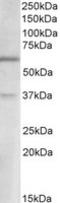 Solute Carrier Family 17 Member 6 antibody, TA320206, Origene, Western Blot image 