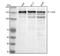 c-met antibody, P01488-1, Boster Biological Technology, Western Blot image 