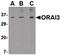 ORAI Calcium Release-Activated Calcium Modulator 3 antibody, PA5-20370, Invitrogen Antibodies, Western Blot image 