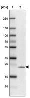 SEH1 Like Nucleoporin antibody, PA5-59012, Invitrogen Antibodies, Western Blot image 