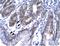 SNF8 Subunit Of ESCRT-II antibody, A08284, Boster Biological Technology, Immunohistochemistry paraffin image 