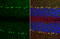 Transient Receptor Potential Cation Channel Subfamily C Member 6 antibody, GTX113858, GeneTex, Immunohistochemistry paraffin image 