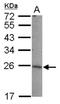 Lin-7 Homolog B, Crumbs Cell Polarity Complex Component antibody, NBP2-19358, Novus Biologicals, Western Blot image 