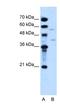 Dihydroorotate Dehydrogenase (Quinone) antibody, NBP1-59591, Novus Biologicals, Western Blot image 