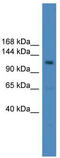 Ubiquitin Specific Peptidase 38 antibody, TA342575, Origene, Western Blot image 