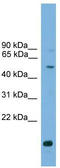 Autophagy Related 4C Cysteine Peptidase antibody, TA344180, Origene, Western Blot image 