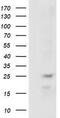 RAB, Member Of RAS Oncogene Family Like 2A antibody, M14567-1, Boster Biological Technology, Western Blot image 