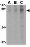 BR Serine/Threonine Kinase 2 antibody, GTX85053, GeneTex, Western Blot image 