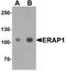Endoplasmic Reticulum Aminopeptidase 1 antibody, A02021-1, Boster Biological Technology, Western Blot image 