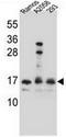 HOP Homeobox antibody, AP52072PU-N, Origene, Western Blot image 