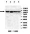 Protein-Glucosylgalactosylhydroxylysine Glucosidase antibody, orb154873, Biorbyt, Immunohistochemistry paraffin image 