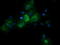 Retinoic Acid Receptor Responder 1 antibody, LS-C174675, Lifespan Biosciences, Immunofluorescence image 