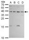 ERCC Excision Repair 1, Endonuclease Non-Catalytic Subunit antibody, GTX129282, GeneTex, Western Blot image 