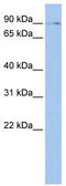 BMP-2-inducible protein kinase antibody, TA344135, Origene, Western Blot image 