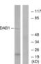 Disabled homolog 1 antibody, LS-B9240, Lifespan Biosciences, Western Blot image 