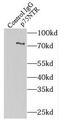 p75 ICD antibody, FNab06091, FineTest, Immunoprecipitation image 